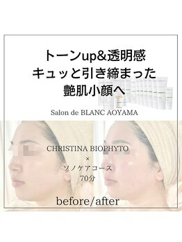 サロン ド ブラン アオヤマ(Salon de BLANC AOYAMA)/BIOPHYTO×Sonocare