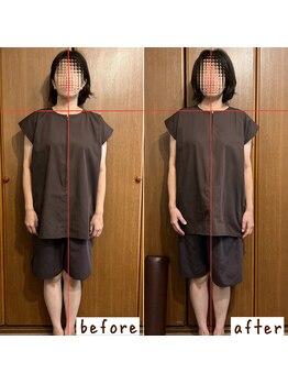 シンシンラボ 豪徳寺(SHINSHIN Lab)/身体のアンバランス・歪みを改善