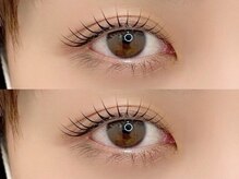 アイプラスサンテ (eye+sante)