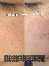 アイビー 長崎店(+i.b)/フェイスワックス