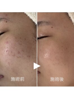 シェノン 赤坂大濠店/