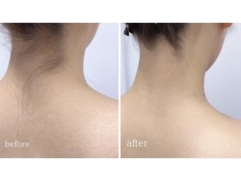 アンドエピ(&epi)/