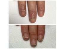 メテ(mete)の雰囲気（深爪や巻き爪、爪でお悩みの方はご相談ください！）