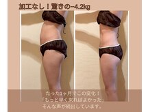 ヨサパーク リナータ(YOSA PARK Rinata)/1ヶ月で激変！感動の結果続出中