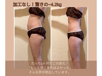 ヨサパーク リナータ(YOSA PARK Rinata)/1ヶ月で激変!感動の結果続出中