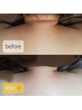 プリマ(prima)/張りが治まり、スッとした首筋に