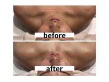 サロン シェリール(Salon Cherir)/小顔調整（首肩）