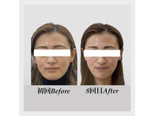 ウニカ(Unica)の雰囲気（別人のような変化と絶賛頂きました！！）