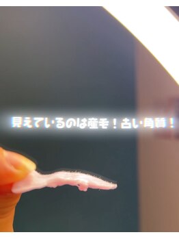 ジョエルワックス 沖縄那覇店(JOELLE WAX)/とれた後のWAXはこんな感じ！！