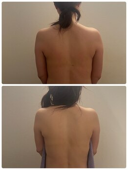 ジェーピーユキノ(jp.yukino)の写真/天候不順による身体のだるさ、不眠、頭痛、自律神経の乱れをマッサージで整えむくみスッキリ！