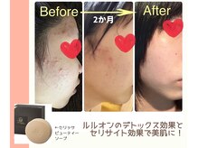 ヨサパーク ハヌル 住吉 錦糸町(YOSA PARK Haneul)/デトックス＆セリサイトで美肌