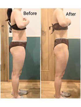 まろんのエステ/40代 痩身エステ(下半身)