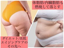 ヨサパーク クレオメ(YOSAPARK Cleome)