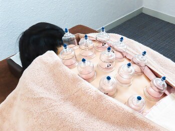 高麗鍼灸院/カッピング