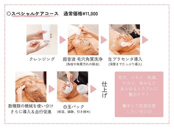 ミュー 金山店(mieux)/スペシャルケアコース