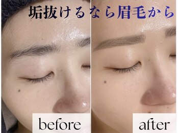 ティーネイルアンドアイラッシュ(tty)の写真/【WAX脱毛美眉¥3900】第一印象を左右する眉のお手入れはプロにお任せ★魅力を最大限に引き出します!