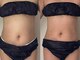 キララ(Kirara)の写真/ホルミシスの力と熟練のオールハンド◎八尾で本気のボディメイクなら、確かな実績の kirara へ。