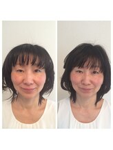 エンドリングフェイシャル専門サロン ムーンティア/エンドリングフェイシャル小顔