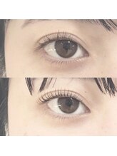 abp /ラッシュリフト