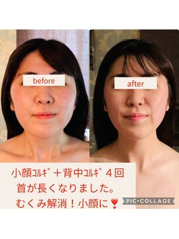 ウルワシ(Uruwashi)/★ビフォーアフター★