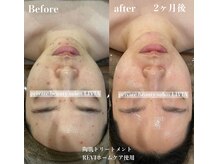 リビア(LIVIA)の雰囲気（SNSで話題！REVIスキンケアと陶肌トリートメントで肌質改善☆）