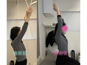 ルミエール(Rumiere)/肩の可動域拡大