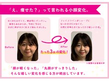 理想の小顔 福島店/定額制でお財布に優しいサロン