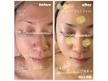 ウィム(whim)の雰囲気（サロントリートメントとホームケアで、自分に合う肌質改善を）