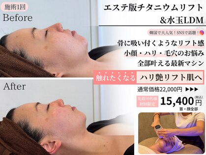 ララピール 五反田(Lavinity)の写真