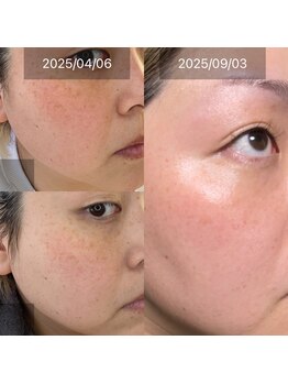 グレイス(Grace)/リアクションあります