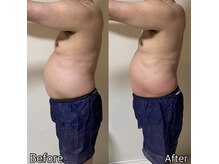 エステ リラクゼーションサロン(more)/お腹集中引き締め/ダイエット