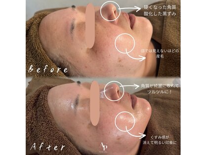 アピュルテ(A purete')の写真