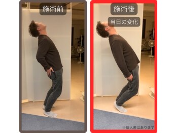 まこと整骨院/急なぎっくりな腰の当日の変化２