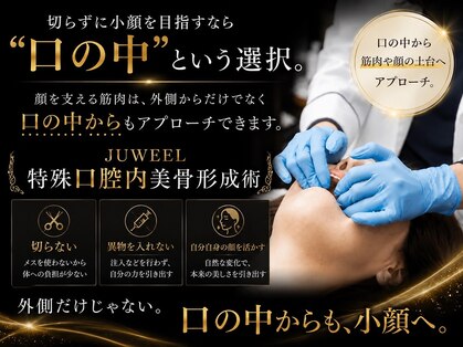 ユウェール(JUWEEL)の写真