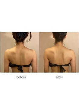 ラズ(Luz)/【小顔130分コース】