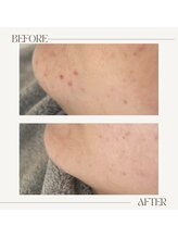 アンド(&.)/before/after