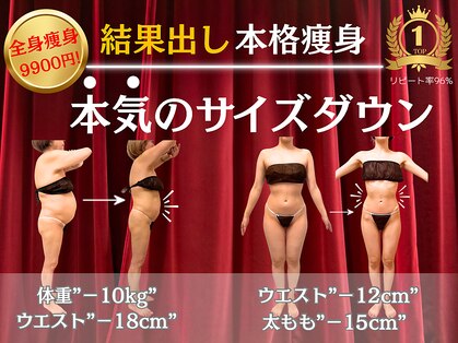 ルポーゼ(Repose)の写真