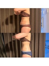 カシェット(cachette)/ウルトラ痩身3ヶ月