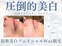 シロ(siro)/くすみ・加齢による肌悩み