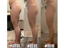 痩身革命 大宮店/ダイエットリンパマッサージ