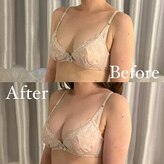 ベルファム(BelleFemme)