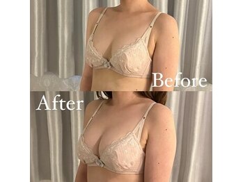 ベルファム(BelleFemme)