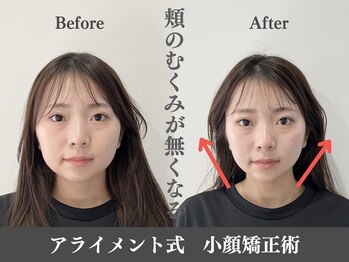 アライメントトウキョウ 麻布十番(Alignment TOKYO)/むくみの改善☆