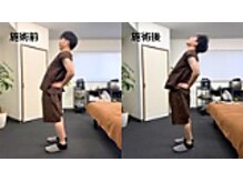 リカバリーサロンタップ(Recovery salon TAP)/腰痛の方のbefore/after