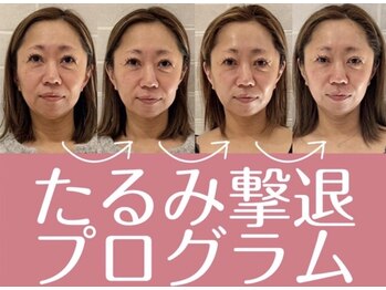 ネルジム 札幌店(NERU GYM)の写真/ほうれい線・たるみを徹底改善！ハリ感と引き締まりを実感◎透明感と若々しさを引き出すケアで自信UP☆