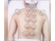 力道の写真/体の湿気を吸玉でデトックス！人気の全身整体と、吸玉施術のセットコース。施術後の効果が高い