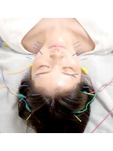 リフレッシュ ミスターマックスおゆみ野店/肌質改善したい方