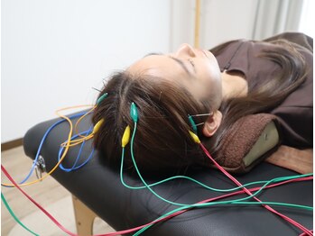 リコンディショニング 自由が丘(Reconditioning)/■鍼灸施術/頭■