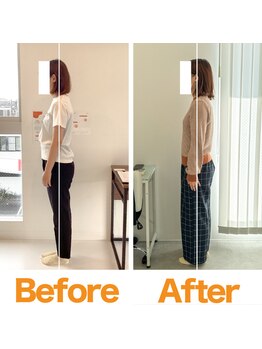 整体院ひなた 宮崎院/産後の姿勢(猫背反り腰)が改善!!