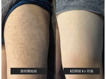 ドシースキンラボ(℃ SKINLAB)/最速で卒業！